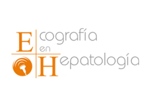 Ecografía diagnóstica y elastografía en hepatología