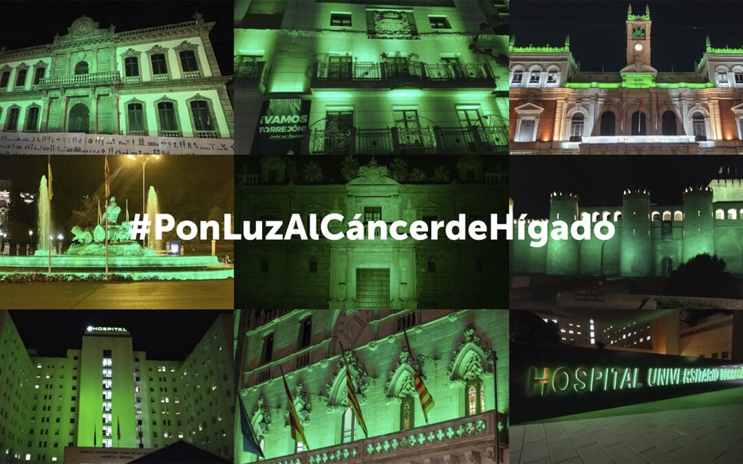 #PonLuzAlCáncerdeHígado