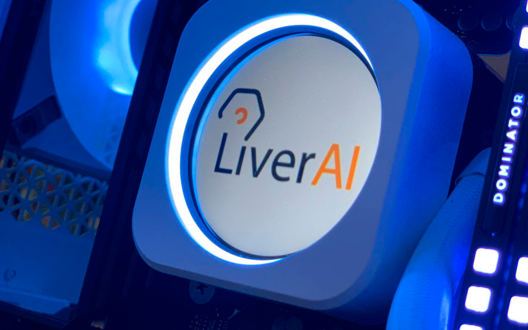 LiverAI 2.0 con muchas mejoras