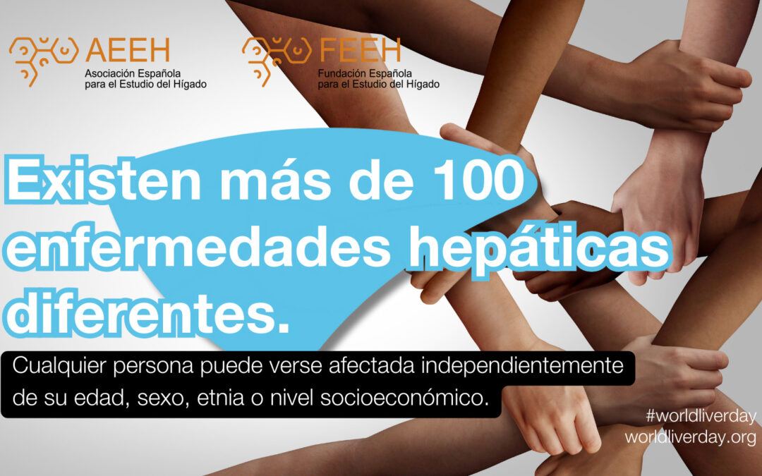 #WorldLiverDay: Las enfermedades hepáticas necesitan una mayor atención política