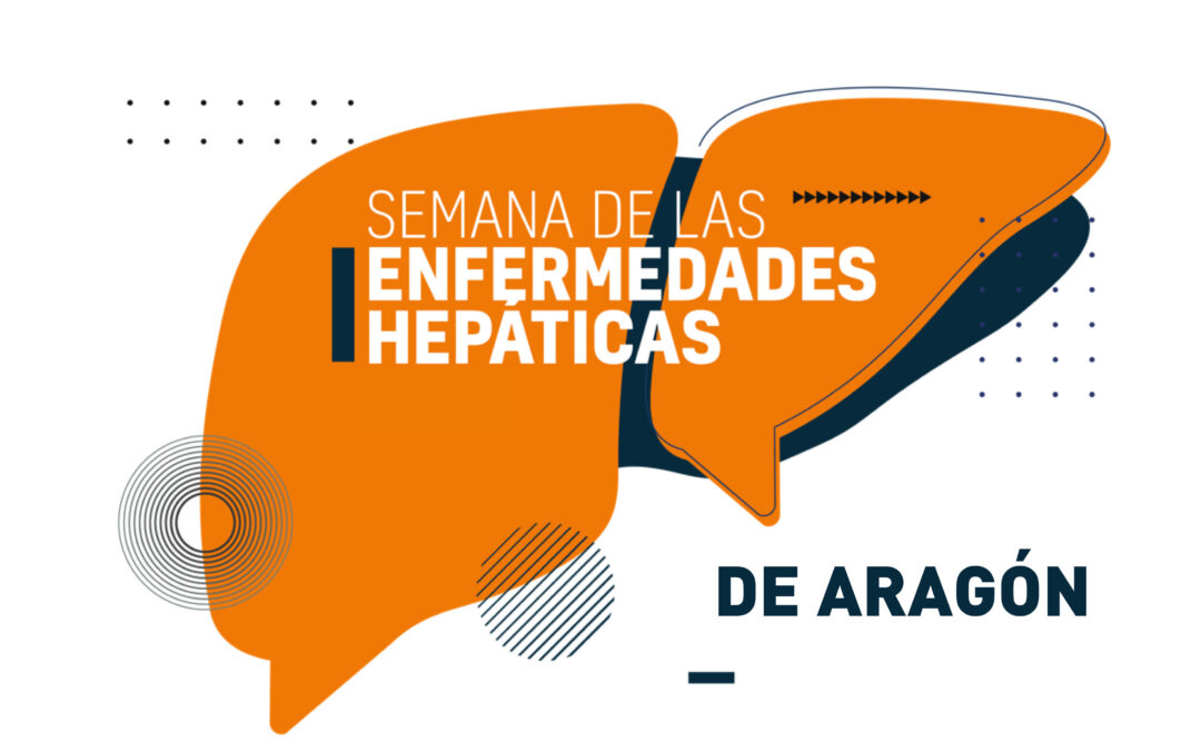 Aragón celebra la Semana de las Enfermedades Hepáticas del 18 al 20 de Junio